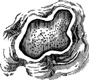 FIG. 2. CALCAREOUS CONCRETION IN AEOLIAN LIMESTONE, BERMUDAS.